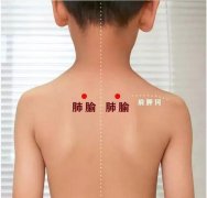 小兒推拿培訓小兒推拿手法應該注意哪些事項？