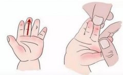 花都小兒推拿培訓|小兒發熱推拿及中醫特色療法