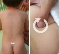 廣州小兒推拿培訓|小孩感冒流鼻涕推拿手法